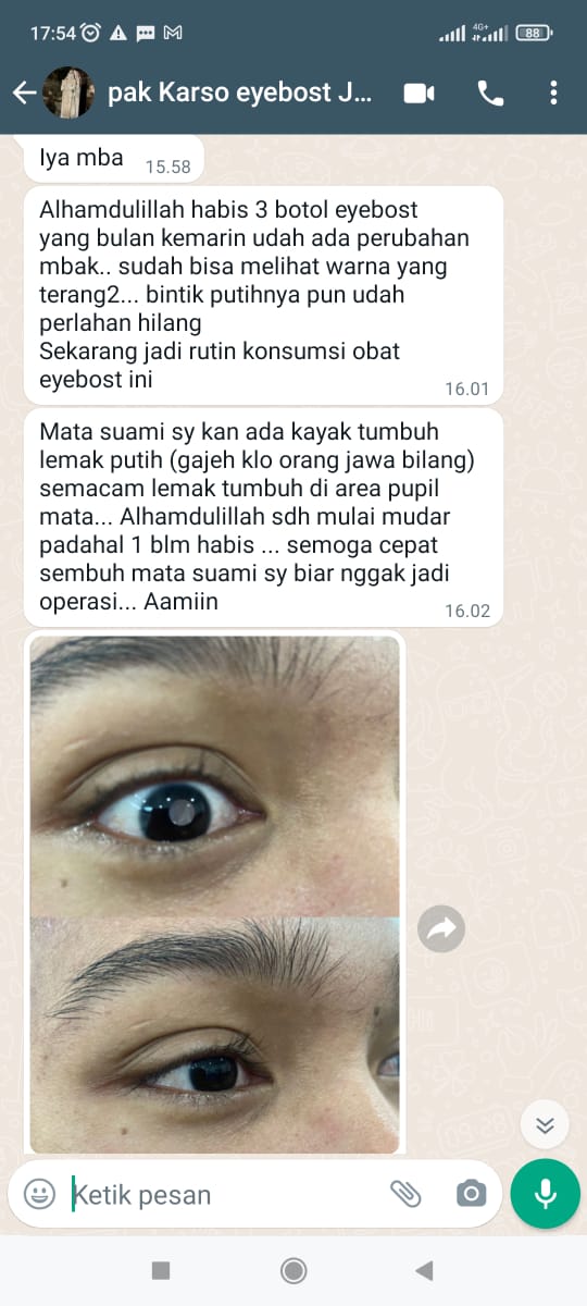 testi katarak 1