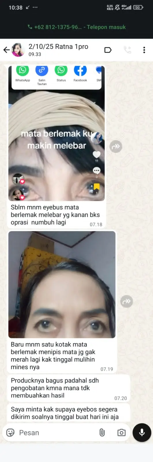 LEMAK-MATA-DAN-MINUS.webp